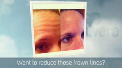 Most effective Anti Aging Serum - A Video Tutorial