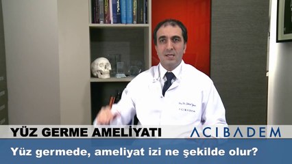 Yüz germede ameliyat izi ne şekilde olur?