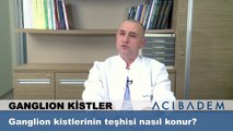 Ganglion kistlerin teşhisi nasıl konur?