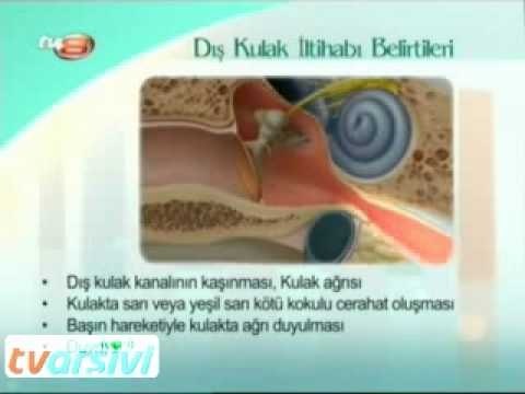 Dış Kulak İltihabı Belirtileri Nelerdir