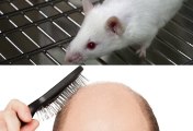 Transplanted Cells May Cure Baldness And Hair Loss