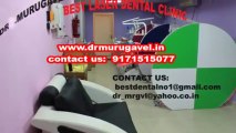 Dancing teeth due to gum weakness-dental implant centre in india