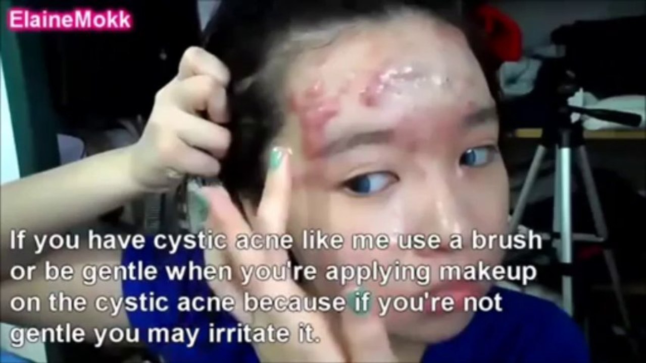 INCREÍBLE :VIDEO MUESTRA CÓMO ESCONDER RASTROS DE ACNÉ CON MAQUILLAJE