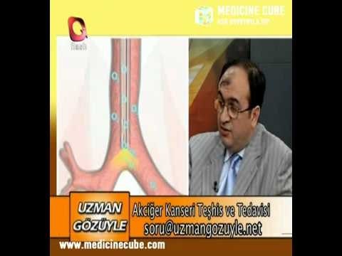 Akciğer Kanseri Tedavisi-akciğer Kanserinin Belirtileri-Akciğer Kanseri Erken Teşhis-2