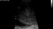 Échographie in utero d'un poulain de 5 mois