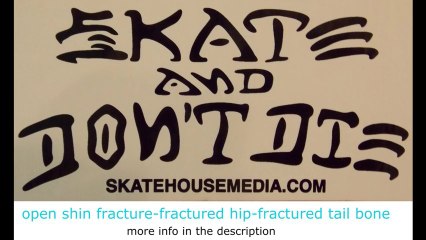 Longboardeur vs Glissière de sécurité