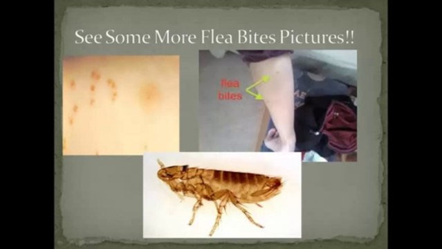 Flea Bites on Humans and Pets