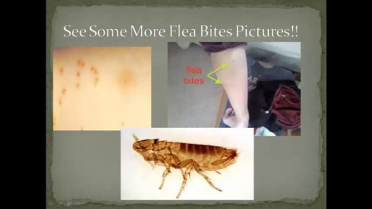 Flea Bites on Humans and Pets