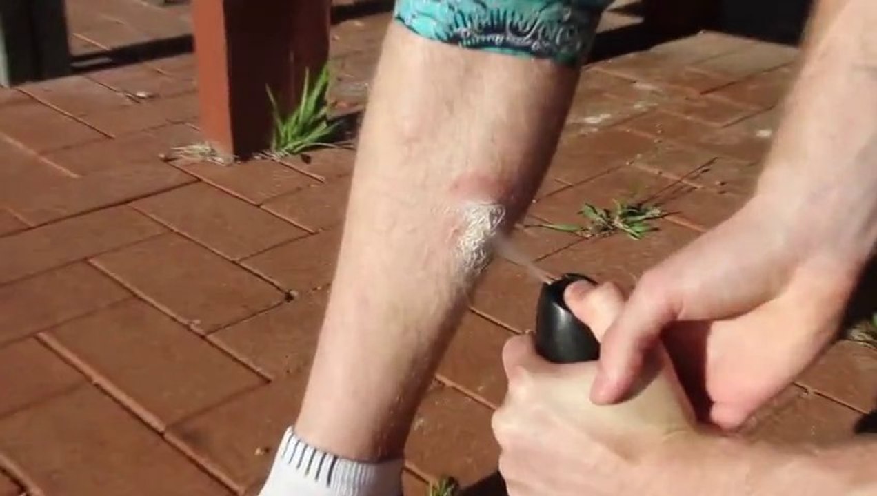 Challenge : se brûler avec une bombe aérosol.