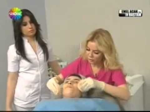 Cilt lekelerine peeling tedavisi-Cilt lekeleri ve kırışıklıkları için doğal cilt bakımı