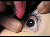 SUPER GROSS: Japanese eyeball licking sees spread of eye chlamydia