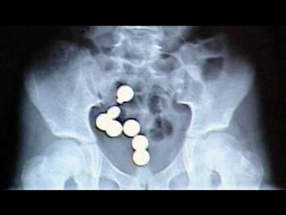 Three Lao women arrested for hiding 4,000 meth pills inside their bodies