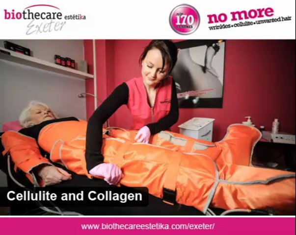 Cellulite and Collagen