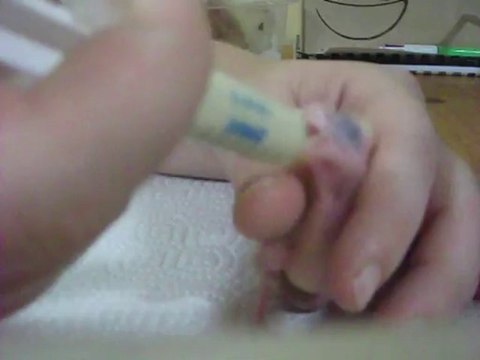 nourrissage bb calopsitte de 11 jours