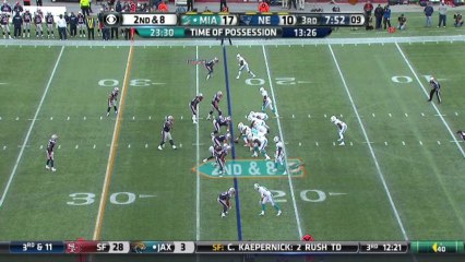 Patriots defense, sack, 10-yd loss