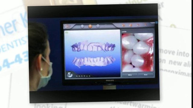 Davie Invisalign Oct2013