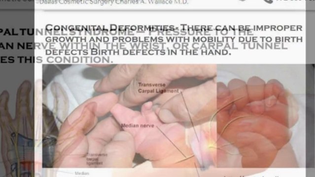 Get the Type of Hand Surgery Can Cure are as follows