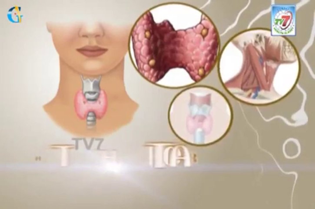 A variety of ear, nose and throat disorders can cause headache.