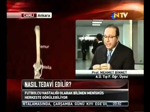 MENİSKUS TEDAVİSİ-MENİSKÜS AĞRILARI NASIL TEDAVİ EDİLİR AMELİYATI NEDİR