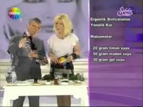 Sivilce Nasıl Geçer-Ahmet Maranki Ergenlik Sivilcelerine Kesin Bitkisel Çözüm Kürü