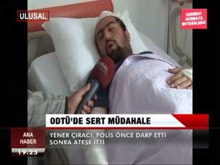 ODTÜ'DE SERT MÜDAHALE