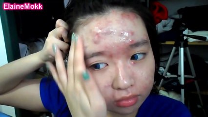 Une étudiante cache son acné avec du maquillage