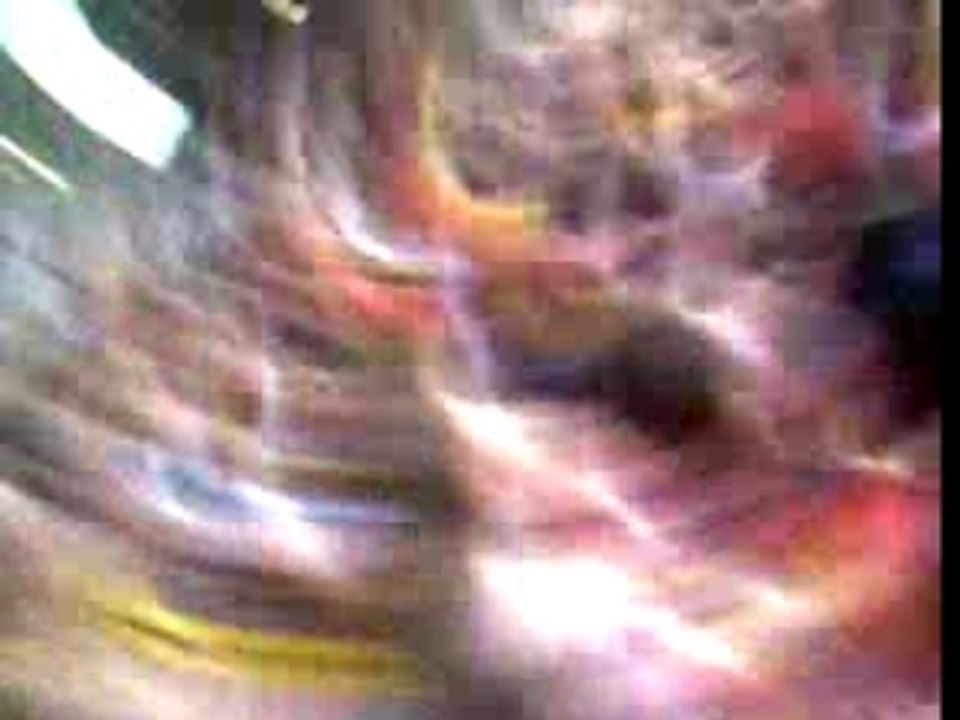 Lens nante 2
