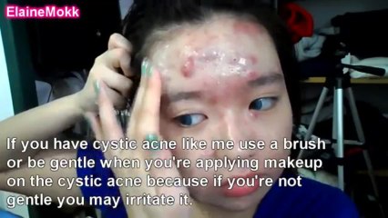 Cacher son acné avec du maquillage