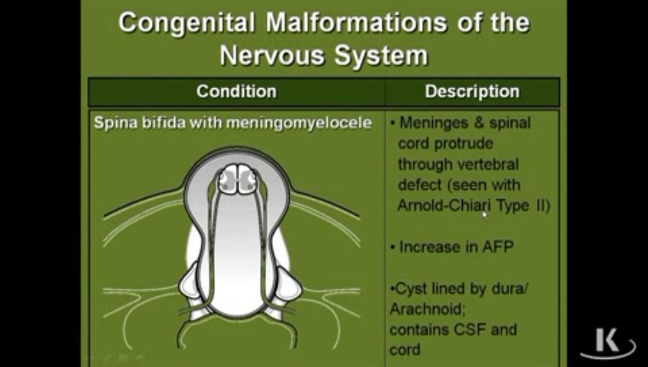 Nervous System