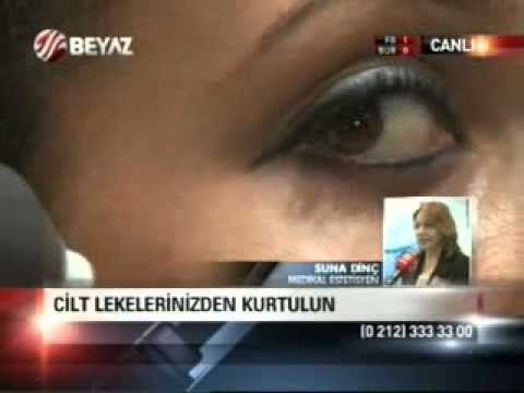 Cilt Lekelerine Kesin Çözüm-Yüzdeki Cilt Lekeleri Nasıl Geçer