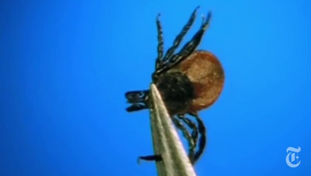 The Tick Explained.