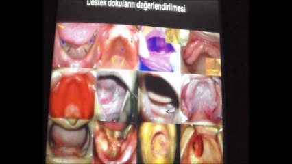 PROF.DR.HÜSNÜ YAVUZYILMAZ 10 EKİM 2013 ADO EĞİTİM SEMİNERİ 1