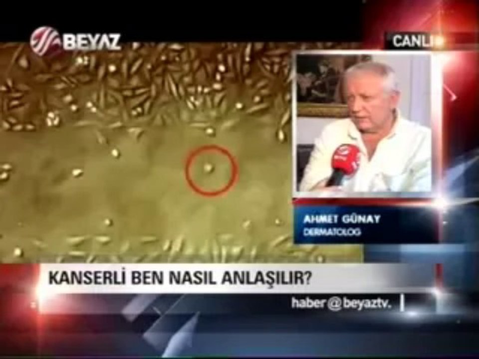 Kanserli ben hakkında bilgi