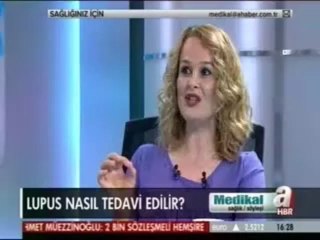 Lupusun nedenleri ve tedavi yöntemleri (Part 2)