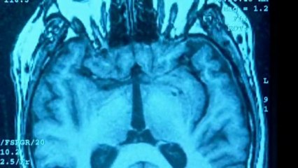 The Final Mystery - BBC Brain Story 6 of 6 (multilanguage captions)