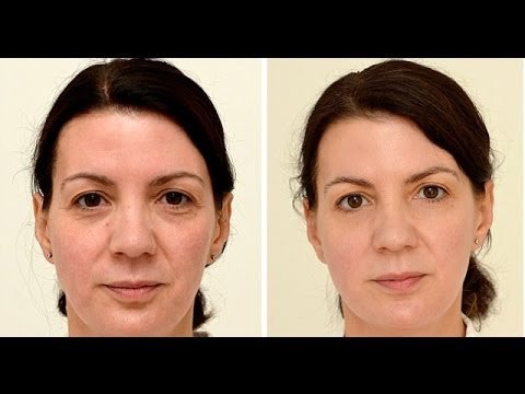 Drinking three liters of water a day gives you younger skin: study