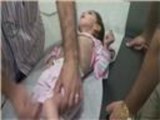 معاناة أطفال المناطق المحاصرة في سوريا