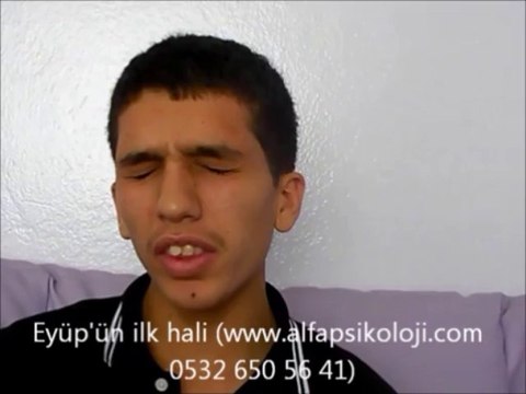 kekemelik, kekemelik,kekemelik,kekemelik nedir, kekeme, kekemelik tedavisi, çocuklarda kekemelik, kekemelik merkezleri, kekemelik gaziantep, gaziantep kekemelik, kekemelik kitabı, kekemelik ve 5 boyut terapisi, kekemelik belirtileri, kekemelik nedenleri