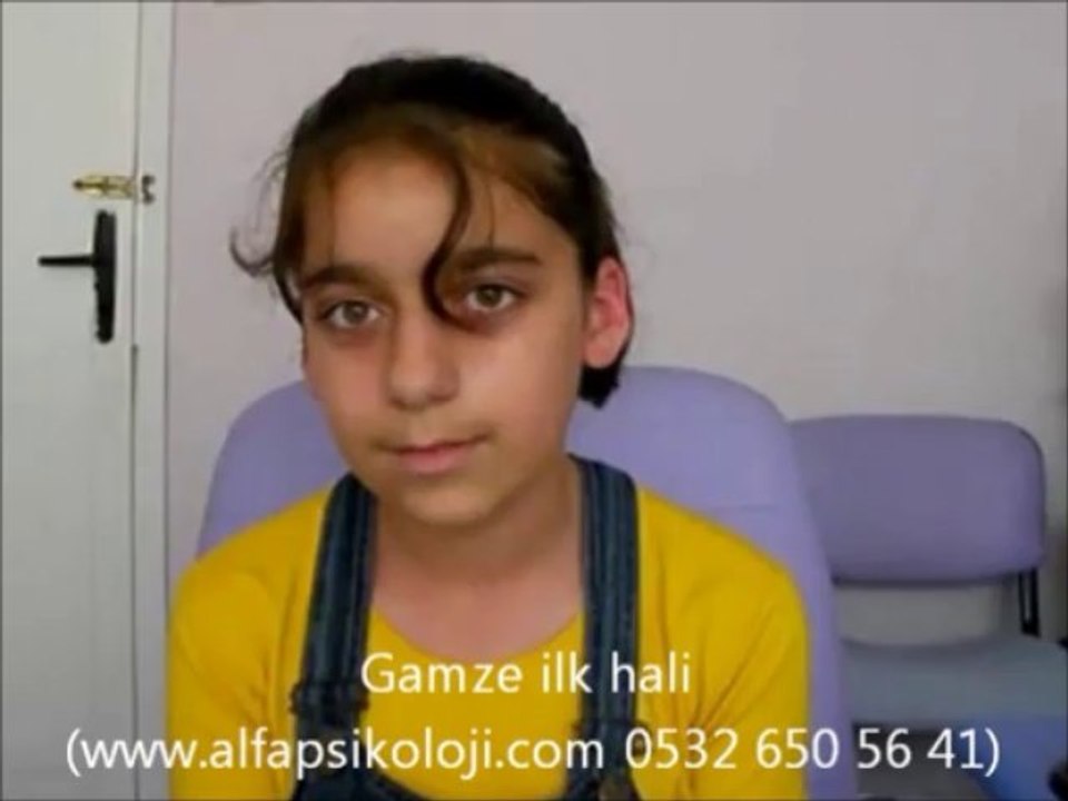 kekemelik, kekeme, kekemelik,kekemelik,kekemelik nedir, kekeme, kekemelik tedavisi, çocuklarda kekemelik, kekemelik merkezleri, kekemelik gaziantep, gaziantep kekemelik, kekemelik kitabı, kekemelik ve 5 boyut terapisi, kekemelik belirtileri