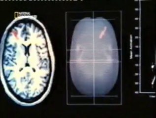 Cerebro: Toma de decisiones (La paradoja de la eleccion)