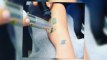 Kelly Osbourne Shares Tattoo Removal Snap