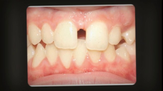 Dallas Orthodontists Oct2013