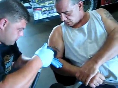 Tatouage effacé à la ponceuse