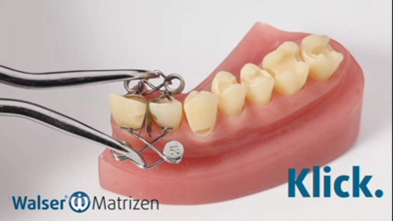 Walser® teilmatrizen: anwendung xf-form zahn matrize