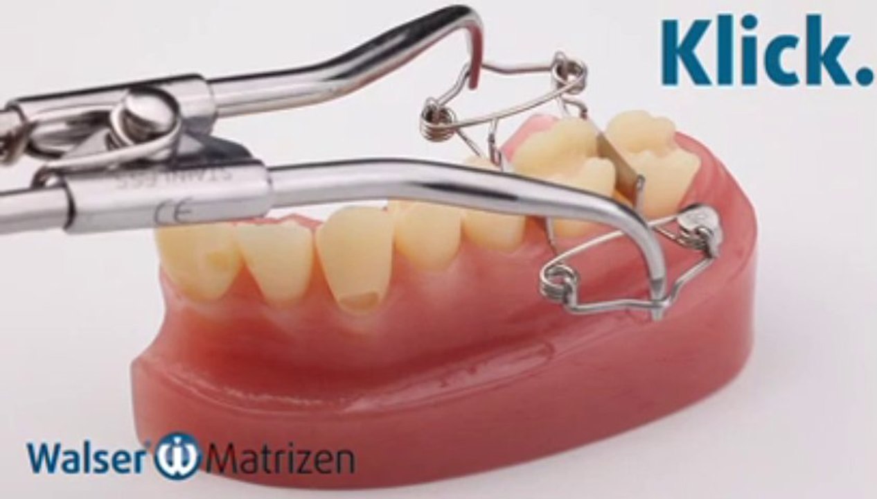 Walser® Teilmatrizen: Anwendung O-Form Zahn Matrize