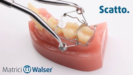 Walser® Matrici Sezionali: L'applicazione forma ON da matrix dentale
