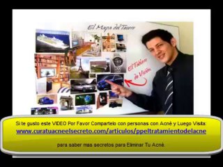 Productos para el tratamiento del acné SECRETO 1