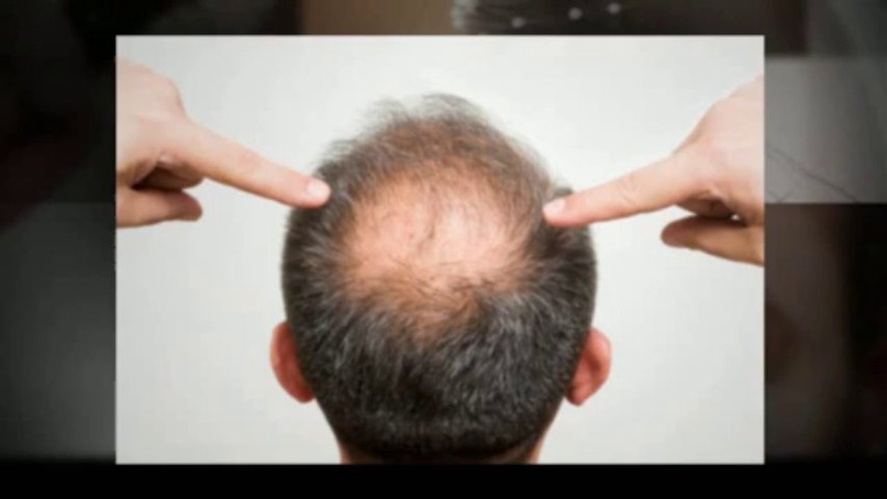 Hair Multiplication