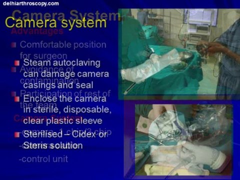 Arthroscopic instruments - Arthroscopic Surgeon,Knee Surgery Specialist Delhi