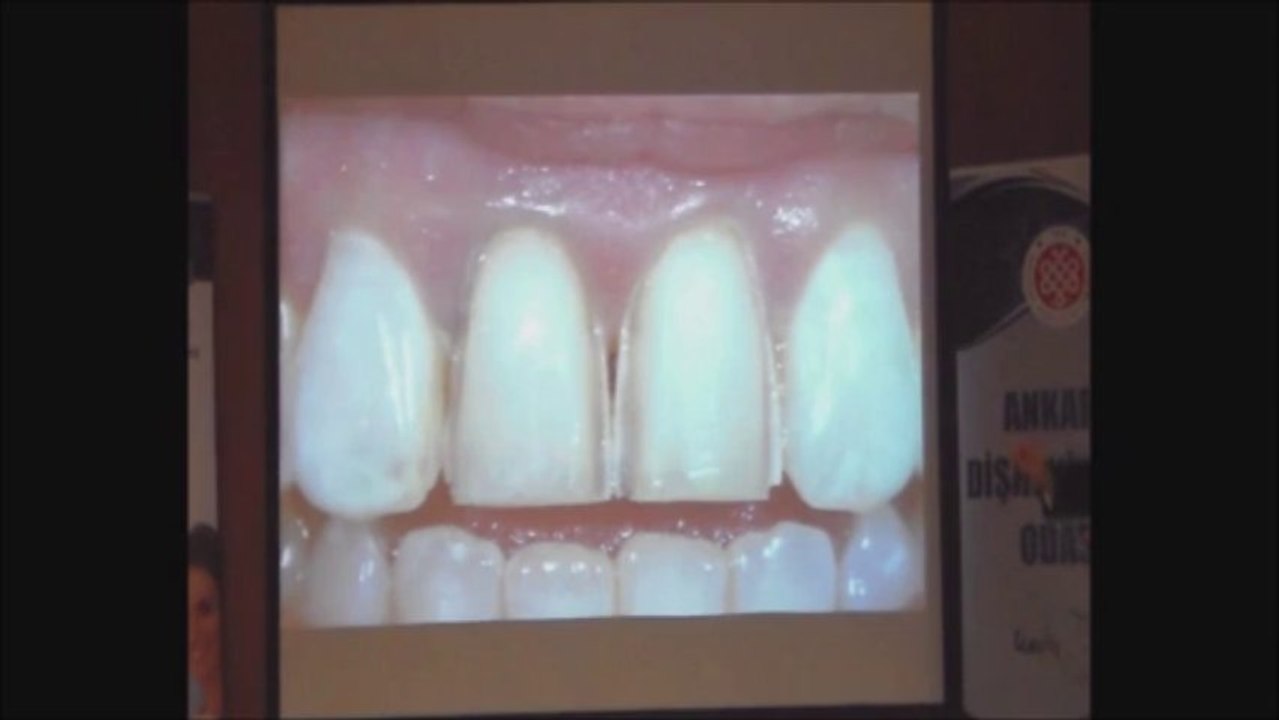 DOÇ.DR.MURAT DİKMEN 7 KASIM 2013 ADO EĞİTİM SEMİNERİ